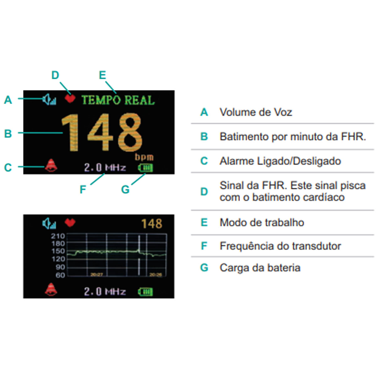 Detector Fetal Doppler MD Portatil Digital Bateria Recarregavel FD200C LCD Colorido