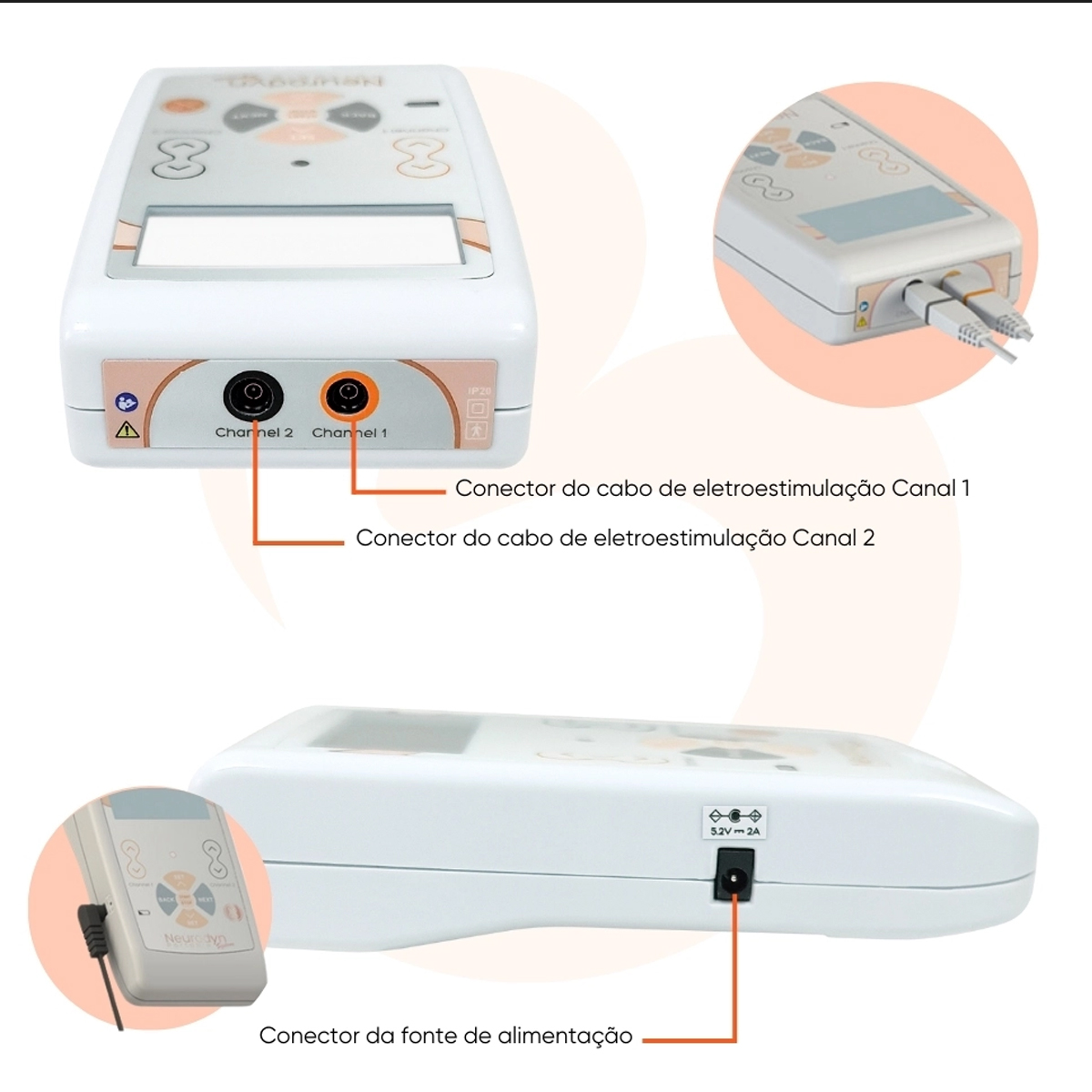 Neurodyn Portable System 2 Canais com 5 Correntes Russa Tens Fes Aussie Ibramed